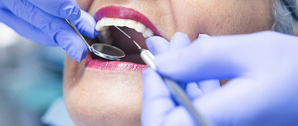Best Emergency Tooth Extraction in Toppenish, WA
